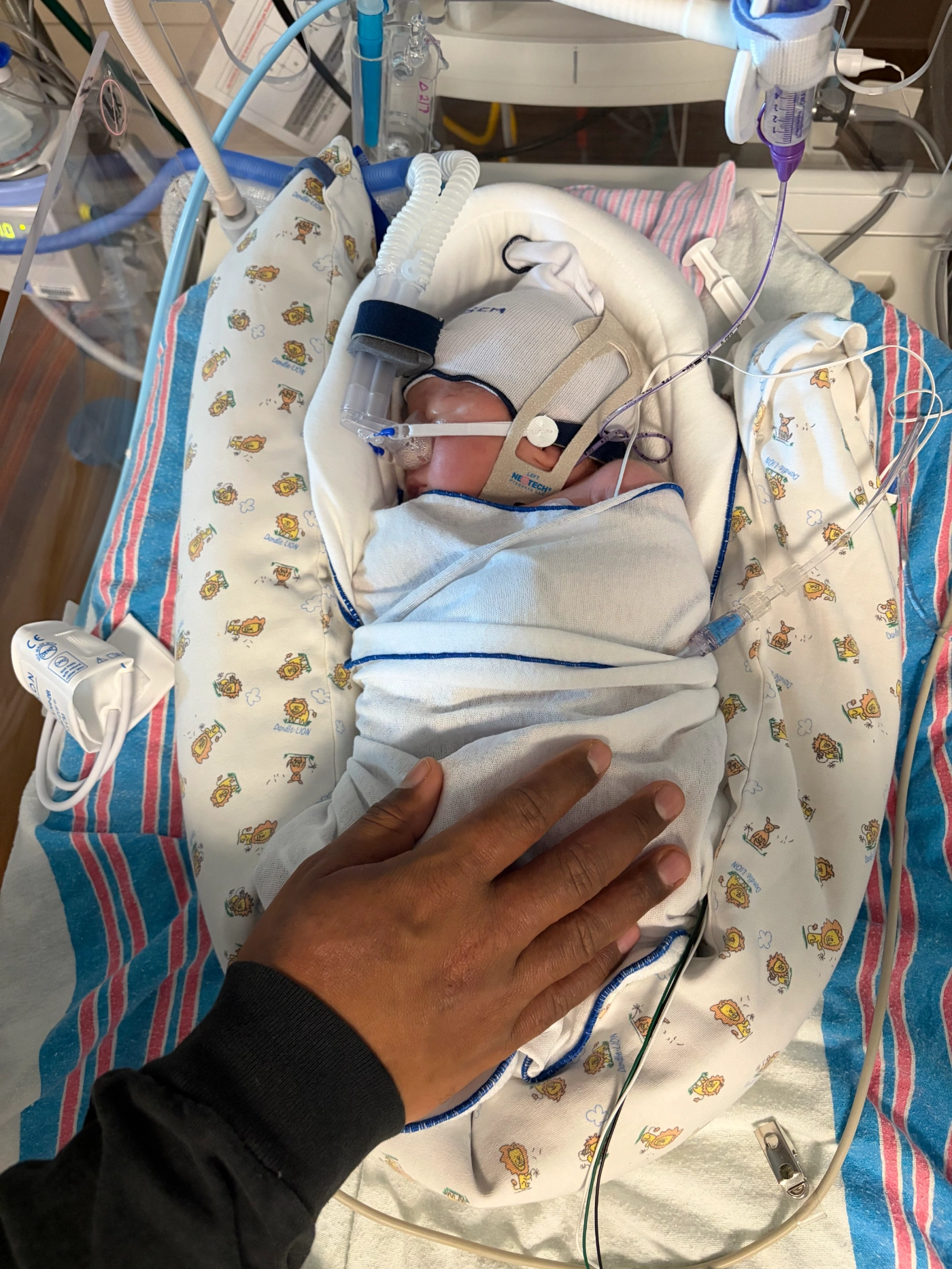 aurora-baycare-nicu-support